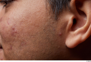 HD Face Skin Ithamar Jung cheek ear face skin pores…